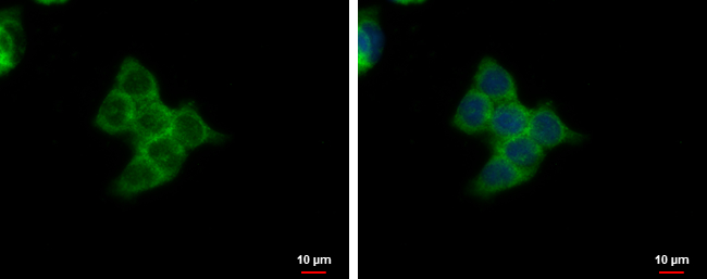 SMYD3 antibody