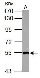 Sample (50 ug of whole cell lysate) A: mouse heart 7.5% SDS PAGE GTX122067 diluted at 1:1000