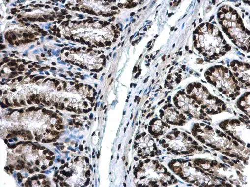 Anti-Histone H3 antibody (GTX122148) | GeneTex