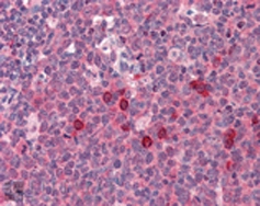 Immunohistochemistry analysis of human tonsil tissue stained with rSec6,mAb (9H5) at 10ug/ml.