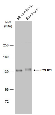 Various tissue extracts (50 μg) were separated by 5% SDS-PAGE, and the membrane was blotted with CYFIP1 antibody [N1N2], N-term (GTX122467) diluted at 1:1000. The HRP-conjugated anti-rabbit IgG antibody (GTX213110-01) was used to detect the primary antibody.
