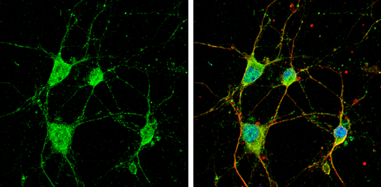 CYFIP1 antibody [N1N2], N-term detects CYFIP1 protein by immunofluorescent analysis. Sample: DIV9 rat E18 primary cortical neuron cells were fixed in 4% paraformaldehyde at RT for 15 min. Green: CYFIP1 stained by CYFIP1 antibody [N1N2], N-term (GTX122467) diluted at 1:500. Red: beta Tubulin 3/ Tuj1, stained by beta Tubulin 3/ Tuj1 antibody [GT1338] (GTX631831) diluted at 1:500. Blue: Fluoroshield with DAPI (GTX30920).