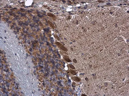 KBTBD3 antibody detects KBTBD3 protein at cytoplasm in mouse brain by immunohistochemical analysis. Sample: Paraffin-embedded mouse brain. KBTBD3 antibody (GTX122513) diluted at 1:500.
Antigen Retrieval: Citrate buffer, pH 6.0, 15 min KBTBD3 antibody detects KBTBD3 protein at cytoplasm in mouse brain by immunohistochemical analysis. Sample: Paraffin-embedded mouse brain. KBTBD3 antibody (GTX122513) diluted at 1:500.
Antigen Retrieval: Citrate buffer, pH 6.0, 15 min