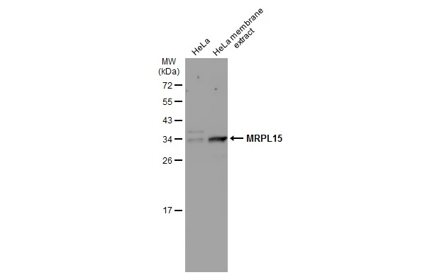 HeLa whole cell and membrane extracts (30 μg) were separated by 12% SDS-PAGE, and the membrane was blotted with MRPL15 antibody (GTX122571) diluted at 1:500. The HRP-conjugated anti-rabbit IgG antibody (GTX213110-01) was used to detect the primary antibody, and the signal was developed with Trident ECL plus-Enhanced.