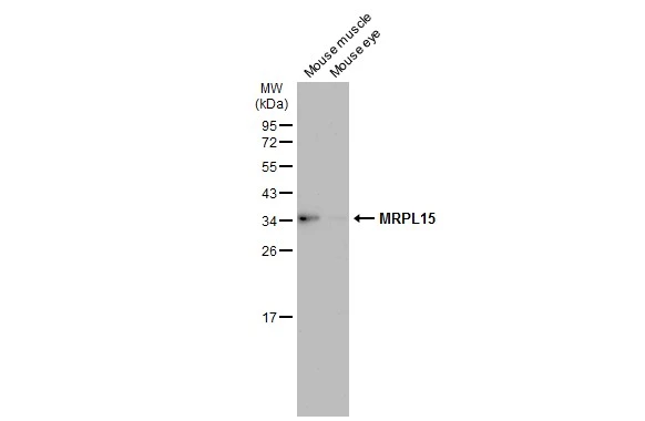 Various tissue extracts (50 μg) were separated by 12% SDS-PAGE, and the membrane was blotted with MRPL15 antibody (GTX122571) diluted at 1:500. The HRP-conjugated anti-rabbit IgG antibody (GTX213110-01) was used to detect the primary antibody, and the signal was developed with Trident ECL plus-Enhanced.