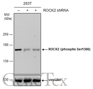 Non-transfected (–) and transfected (+) 293T whole cell extracts (30 μg) were separated by 5% SDS-PAGE, and the membrane was blotted with ROCK2 (phospho Ser1366) antibody (GTX122651) diluted at 1:500. The HRP-conjugated anti-rabbit IgG antibody (GTX213110-01) was used to detect the primary antibody.