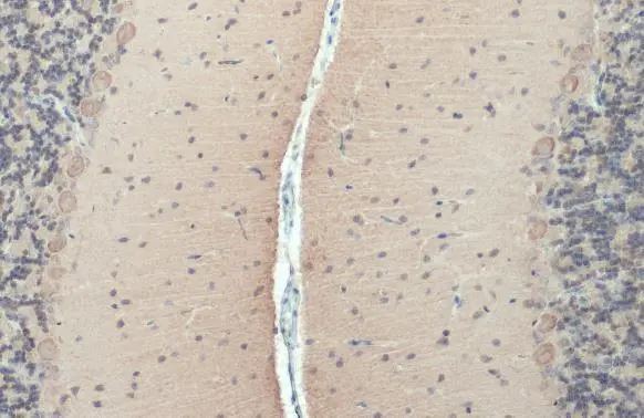 Anti-ROCK2 (phospho Ser1366) antibody (GTX122651) | GeneTex