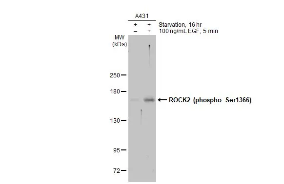 Untreated (–) and treated (+) A431 whole cell extracts (30 μg) were separated by 5% SDS-PAGE, and the membrane was blotted with ROCK2 (phospho Ser1366) antibody (GTX122651) diluted at 1:1000. The HRP-conjugated anti-rabbit IgG antibody (GTX213110-01) was used to detect the primary antibody, and the signal was developed with Trident ECL plus-Enhanced.