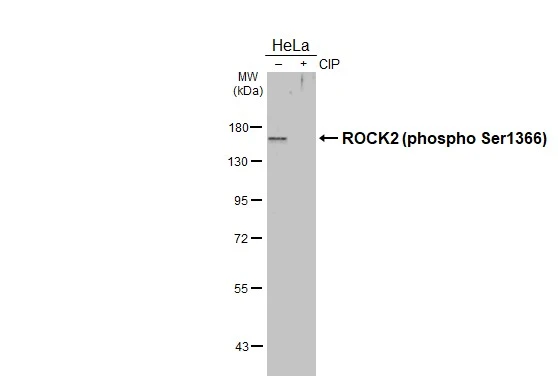 Untreated (–) and treated (+) HeLa whole cell extracts (30 μg) were separated by 7.5% SDS-PAGE, and the membrane was blotted with ROCK2 (phospho Ser1366) antibody (GTX122651) diluted at 1:1000. The HRP-conjugated anti-rabbit IgG antibody (GTX213110-01) was used to detect the primary antibody, and the signal was developed with Trident ECL plus-Enhanced.