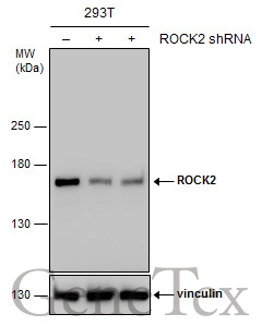 Non-transfected (–) and transfected (+) 293T whole cell extracts (30 μg) were separated by 5% SDS-PAGE, and the membrane was blotted with ROCK2 antibody (GTX122652) diluted at 1:4000.