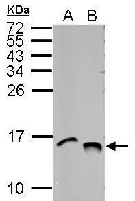 Histone H4K5K8K12K16ac (acetyl Lys5/Lys8/Lys12/Lys16) antibody detects Histone H4K5K8K12K16ac (acetyl Lys5/Lys8/Lys12/Lys16) protein at nucleus by immunofluorescent analysis.