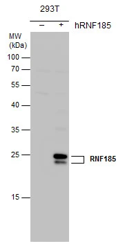 RNF185 antibody [N1C3]