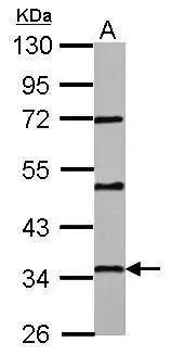 PAQR6 antibody