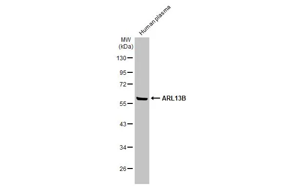 Human plasma (30 μg) was separated by 10% SDS-PAGE, and the membrane was blotted with ARL13B antibody (GTX122703) diluted at 1:10000. The HRP-conjugated anti-rabbit IgG antibody (GTX213110-01) was used to detect the primary antibody. Human plasma (30 μg) was separated by 10% SDS-PAGE, and the membrane was blotted with ARL13B antibody (GTX122703) diluted at 1:10000. The HRP-conjugated anti-rabbit IgG antibody (GTX213110-01) was used to detect the primary antibody.
