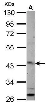 Sample (50 μg of whole cell lysate) A: mouse Liver 10% SDS PAGE GTX122703 diluted at 1:1000 The HRP-conjugated anti-rabbit IgG antibody (GTX213110-01) was used to detect the primary antibody. Sample (50 μg of whole cell lysate) A: mouse Liver 10% SDS PAGE GTX122703 diluted at 1:1000 The HRP-conjugated anti-rabbit IgG antibody (GTX213110-01) was used to detect the primary antibody.