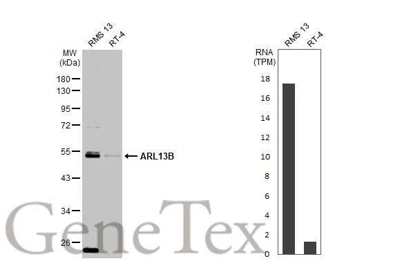 Various whole cell extracts (30 μg) were separated by 10% SDS-PAGE, and the membrane was blotted with ARL13B antibody (GTX122703) diluted at 1:1000. The HRP-conjugated anti-rabbit IgG antibody (GTX213110-01) was used to detect the primary antibody. Corresponding RNA expression data for the same cell lines are based on Human Protein Atlas program. Various whole cell extracts (30 μg) were separated by 10% SDS-PAGE, and the membrane was blotted with ARL13B antibody (GTX122703) diluted at 1:1000. The HRP-conjugated anti-rabbit IgG antibody (GTX213110-01) was used to detect the primary antibody. Corresponding RNA expression data for the same cell lines are based on Human Protein Atlas program.