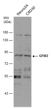 Various whole cell extracts (30 μg) were separated by 7.5% SDS-PAGE, and the membrane was blotted with GFM2 antibody [N3C2], Internal (GTX122890) diluted at 1:500.