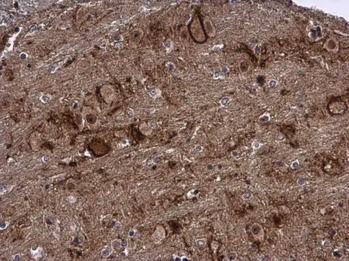LCMT2 antibody detects LCMT2 protein at cytoplasm in mouse brain by immunohistochemical analysis. Sample: Paraffin-embedded mouse brain. LCMT2 antibody (GTX122895) diluted at 1:500. 
 Antigen Retrieval: Citrate buffer, pH 6.0, 15 min