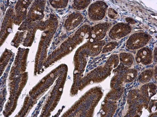 LRRC59 antibody detects LRRC59 protein at cytoplasm in mouse duodenum by immunohistochemical analysis. Sample: Paraffin-embedded mouse duodenum. LRRC59 antibody (GTX122902) diluted at 1:500.
Antigen Retrieval: Citrate buffer, pH 6.0, 15 min LRRC59 antibody detects LRRC59 protein at cytoplasm in mouse duodenum by immunohistochemical analysis. Sample: Paraffin-embedded mouse duodenum. LRRC59 antibody (GTX122902) diluted at 1:500.
Antigen Retrieval: Citrate buffer, pH 6.0, 15 min