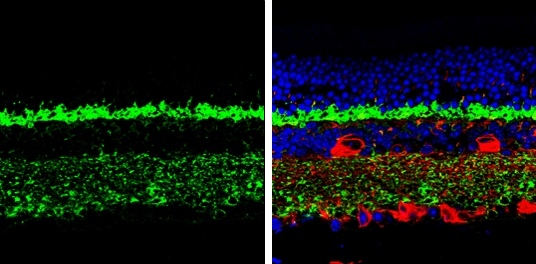 Complexin 3 antibody detects Complexin 3 protein by immunohistochemical analysis. Samples: Paraffin-embedded mouse retina. Green: Complexin 3 protein stained by Complexin 3 antibody (GTX122908) diluted at 1:250. Red: beta Tubulin 3/ Tuj1, a marker, stained by beta Tubulin 3/ Tuj1 antibody [GT1338] (GTX631831) diluted at 1:500. Blue: Fluoroshield with DAPI (GTX30920). 
 Antigen Retrieval: Citrate buffer, pH 6.0, 15 min
