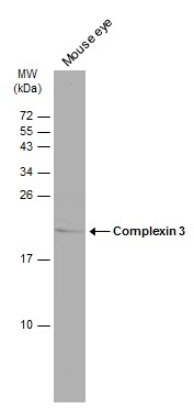 Mouse tissue extract (50 μg) was separated by 15% SDS-PAGE, and the membrane was blotted with Complexin 3 antibody (GTX122908) diluted at 1:500. The HRP-conjugated anti-rabbit IgG antibody (GTX213110-01) was used to detect the primary antibody.
