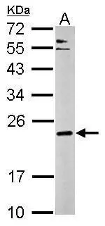 Sample (50 ug of whole cell lysate) A: mouse brain 12% SDS PAGE GTX122908 diluted at 1:1000