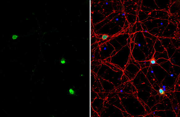 BAF53B antibody detects BAF53B protein by immunofluorescent analysis. Sample: DIV9 rat E18 primary cortical neuron cells were fixed in 4% paraformaldehyde at RT for 15 min. Green: BAF53B stained by BAF53B antibody (GTX122920) diluted at 1:500. Red: beta Tubulin 3/ Tuj1, stained by beta Tubulin 3/ Tuj1 antibody [GT11710] (GTX631836) diluted at 1:500. Blue: Fluoroshield with DAPI (GTX30920).