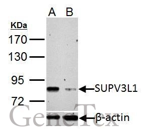 SUPV3L1 antibody [C2C3], C-term detects SUPV3L1 protein by Western blot analysis.<BR/>Upper panel: SUPV3L1 antibody [C2C3], C-term (GTX123034)<BR/>Lower panel: beta Actin antibody (GTX109639)<BR/>A. 30 μg HeLa whole cell lysate/extract<BR/>B. 30 μg whole cell lysate/extract of SUPV3L1 shRNA-transfected HeLa cells<BR/>7.5 % SDS-PAGE<BR/>SUPV3L1 antibody [C2C3], C-term (GTX123034) dilution: 1:1000<BR/>beta Actin antibody (GTX109639) dilution: 1:10000