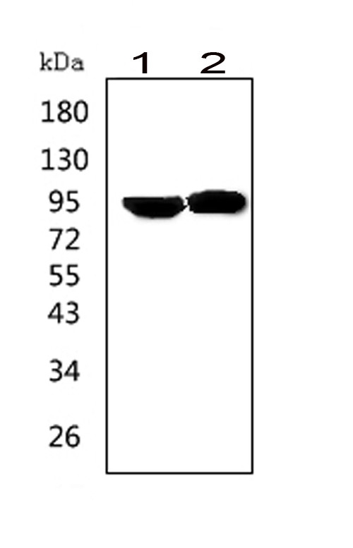 WB analysis of various samples using GTX12307 Prolactin Receptor antibody. Lane 1 : human HeLa whole cell lysates Lane 2 : human MCF-7 whole cell lysates Dilution : 0.5 microg/mL Loading : 50microg of sample under reducing conditions