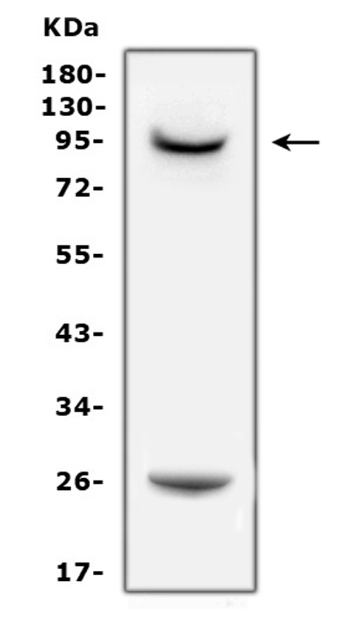 WB analysis of PC-12 whole cell lysate using GTX12307 Prolactin Receptor antibody. Dilution : 0.5 microg/mL Loading : 50microg of sample under reducing conditions