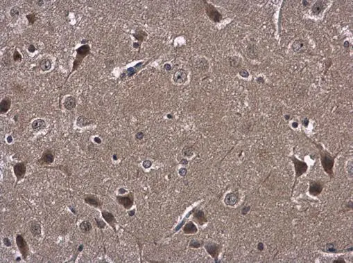 ATL3 antibody detects ATL3 protein at cytoplasm in rat brain by immunohistochemical analysis. Sample: Paraffin-embedded rat brain. ATL3 antibody (GTX123176) diluted at 1:500. 
 Antigen Retrieval: Citrate buffer, pH 6.0, 15 min