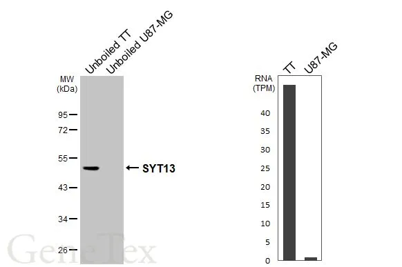 Various unboiled whole cell extracts (30 μg) were separated by 10% SDS-PAGE, and the membrane was blotted with SYT13 antibody (GTX123188) diluted at 1:1000. The HRP-conjugated anti-rabbit IgG antibody (GTX213110-01) was used to detect the primary antibody.