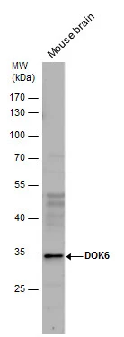 DOK6 antibody detects DOK6 protein by western blot analysis. Mouse tissue extracts (50 μg) was separated by 10 % SDS-PAGE, and the membrane was blotted with DOK6 antibody (GTX123195) diluted by 1:1000.