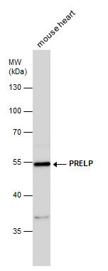 PRELP antibody detects PRELP protein by western blot analysis. Mouse tissue extracts (50 μg) was separated by 10% SDS-PAGE, and the membrane was blotted with PRELP antibody (GTX123359) diluted at 1:500. PRELP antibody detects PRELP protein by western blot analysis. Mouse tissue extracts (50 μg) was separated by 10% SDS-PAGE, and the membrane was blotted with PRELP antibody (GTX123359) diluted at 1:500.