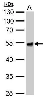 ALDH1A1 antibody detects ALDH1A1 protein by western blot analysis. A. 50 μg mouse liver lysate/extract 10% SDS-PAGE ALDH1A1 antibody (GTX123426) dilution: 1:10000 The HRP-conjugated anti-rabbit IgG antibody (GTX213110-01) was used to detect the primary antibody. ALDH1A1 antibody detects ALDH1A1 protein by western blot analysis. A. 50 μg mouse liver lysate/extract 10% SDS-PAGE ALDH1A1 antibody (GTX123426) dilution: 1:10000 The HRP-conjugated anti-rabbit IgG antibody (GTX213110-01) was used to detect the primary antibody.