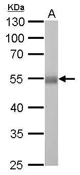 ALDH1A1 antibody detects ALDH1A1 protein by western blot analysis. A. 50 μg rat liver lysate/extract 10% SDS-PAGE ALDH1A1 antibody (GTX123426) dilution: 1:5000 The HRP-conjugated anti-rabbit IgG antibody (GTX213110-01) was used to detect the primary antibody. ALDH1A1 antibody detects ALDH1A1 protein by western blot analysis. A. 50 μg rat liver lysate/extract 10% SDS-PAGE ALDH1A1 antibody (GTX123426) dilution: 1:5000 The HRP-conjugated anti-rabbit IgG antibody (GTX213110-01) was used to detect the primary antibody.