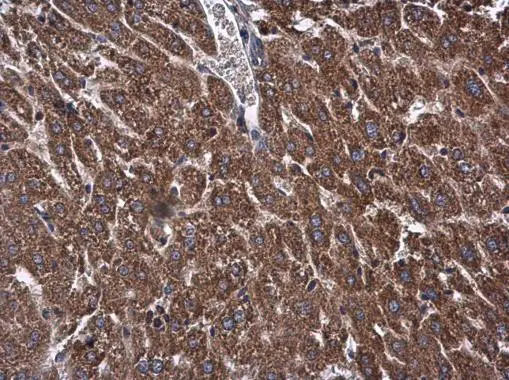 OXSM antibody detects OXSM protein at mitochondria in mouse liver by immunohistochemical analysis. Sample: Paraffin-embedded mouse liver. OXSM antibody (GTX123463) diluted at 1:500.
Antigen Retrieval: Citrate buffer, pH 6.0, 15 min OXSM antibody detects OXSM protein at mitochondria in mouse liver by immunohistochemical analysis. Sample: Paraffin-embedded mouse liver. OXSM antibody (GTX123463) diluted at 1:500.
Antigen Retrieval: Citrate buffer, pH 6.0, 15 min