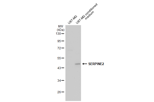 U87-MG whole cell extract and conditioned medium (30 μg) were separated by 10% SDS-PAGE, and the membrane was blotted with SERPINE2 antibody (GTX123522) diluted at 1:5000. The HRP-conjugated anti-rabbit IgG antibody (GTX213110-01) was used to detect the primary antibody.