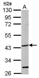 Sample (50 ug of whole cell lysate) A: Rat muscle 10% SDS PAGE GTX123636 diluted at 1:1000 Sample (50 ug of whole cell lysate) A: Rat muscle 10% SDS PAGE GTX123636 diluted at 1:1000