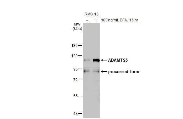 Untreated (–) and treated (+) RMS 13 whole cell extract (30 μg) were separated by 7.5% SDS-PAGE, and the membrane was blotted with ADAMTS5 antibody [N3C2], Internal (GTX123657) diluted at 1:1000. The HRP-conjugated anti-rabbit IgG antibody (GTX213110-01) was used to detect the primary antibody.