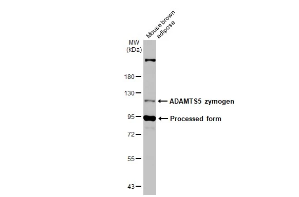 Mouse tissue extracts (50 μg) was separated by 7.5% SDS-PAGE, and the membrane was blotted with ADAMTS5 antibody [N3C2], Internal (GTX123657) diluted at 1:1000. The HRP-conjugated anti-rabbit IgG antibody (GTX213110-01) was used to detect the primary antibody.