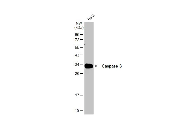 Whole cell extract (30 μg) was separated by 12% SDS-PAGE, and the membrane was blotted with Caspase 3 antibody (GTX123678) diluted at 1:200. The HRP-conjugated anti-rabbit IgG antibody (GTX213110-01) was used to detect the primary antibody.