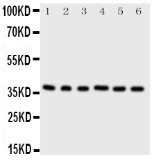 WB analysis of various samples using GTX12373 CDK7 antibody. Lane 1 : rat testis tissue lysate at 50ug Lane 2 : rat ovary tissue lysate at 50ug Lane 3 : HeLa whole cell lysate at 40ug Lane 4 : MCF-7 whole cell lysate at 40ug Lane 5 : A549 whole cell lysate at 40ug Lane 6 : COLO320 whole cell lysate at 40ug Dilution : 0.5 microg/mL WB analysis of various samples using GTX12373 CDK7 antibody. Lane 1 : rat testis tissue lysate at 50ug Lane 2 : rat ovary tissue lysate at 50ug Lane 3 : HeLa whole cell lysate at 40ug Lane 4 : MCF-7 whole cell lysate at 40ug Lane 5 : A549 whole cell lysate at 40ug Lane 6 : COLO320 whole cell lysate at 40ug Dilution : 0.5 microg/mL