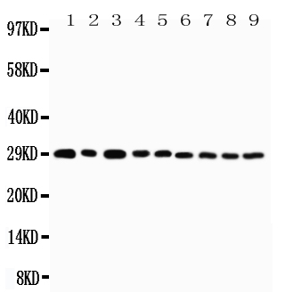 WB analysis of various samples using GTX12380 CD134 antibody. Lane 1 : U87 cell lysate Lane 2 : HeLa cell lysate Lane 3 : HT1080 cell lysate Lane 4 : Jurkat cell lysate Lane 5 : COLO320 cell lysate Lane 6 : MCF-7 cell lysate Lane 7 : SHC cell lysate Lane 8 : COLO320 cell lysate Lane 9 : SGC cell lysate WB analysis of various samples using GTX12380 CD134 antibody. Lane 1 : U87 cell lysate Lane 2 : HeLa cell lysate Lane 3 : HT1080 cell lysate Lane 4 : Jurkat cell lysate Lane 5 : COLO320 cell lysate Lane 6 : MCF-7 cell lysate Lane 7 : SHC cell lysate Lane 8 : COLO320 cell lysate Lane 9 : SGC cell lysate