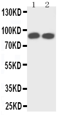 WB analysis of various samples using GTX12390 TrkA antibody. Lane 1 : rat brain tissue lysate Lane 2 : mouse brain tissue lysate WB analysis of various samples using GTX12390 TrkA antibody. Lane 1 : rat brain tissue lysate Lane 2 : mouse brain tissue lysate