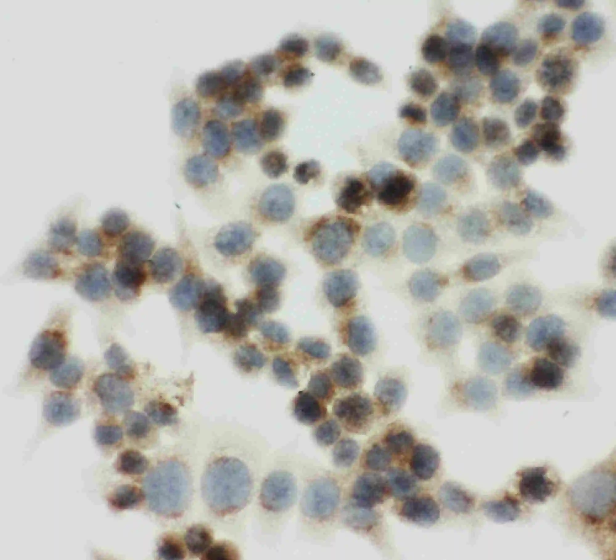 ICC/IF analysis of HCT116 cell using GTX12397 IGF2R antibody. ICC/IF analysis of HCT116 cell using GTX12397 IGF2R antibody.