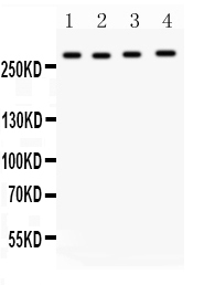 WB analysis of various samples using GTX12397 IGF2R antibody. Lane 1 : HeLa whole cell lysate at 40ug Lane 2 : Jurkat whole cell lysate at 40ug Lane 3 : 22RV1 whole cell lysate at 40ug Lane 4 : 293T whole cell lysate at 40ug Dilution : 0.5 microg/mL