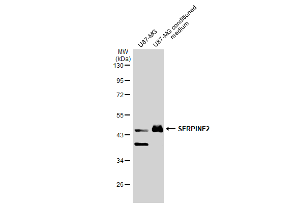 U87-MG whole cell extract and conditioned medium (30 μg) were separated by 10% SDS-PAGE, and the membrane was blotted with SERPINE2 antibody (GTX124069) diluted at 1:2000. The HRP-conjugated anti-rabbit IgG antibody (GTX213110-01) was used to detect the primary antibody.