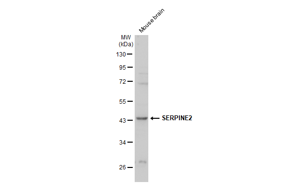 Mouse tissue extract (50 μg) was separated by 10% SDS-PAGE, and the membrane was blotted with SERPINE2 antibody (GTX124069) diluted at 1:2000. The HRP-conjugated anti-rabbit IgG antibody (GTX213110-01) was used to detect the primary antibody.