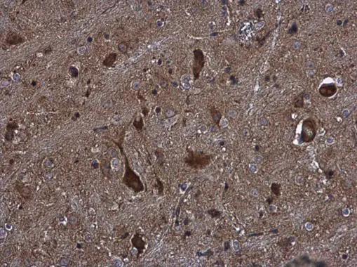KIFC2 antibody [N3C2], Internal detects KIFC2 protein at cytoplasm in mouse brain by immunohistochemical analysis. Sample: Paraffin-embedded mouse brain. KIFC2 antibody [N3C2], Internal (GTX124082) diluted at 1:500. 
 Antigen Retrieval: Citrate buffer, pH 6.0, 15 min